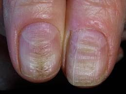 http://crackednail-polish.blogspot.com/2013/07/how-long-do-finger-nails-grow-in-one.html