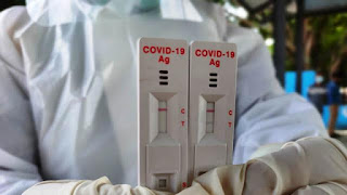 Interpreatasi hasil pemeriksaan antigen SARS-CoV-2.