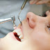 Quy trình cạo vôi răng an toàn cần những tiêu chí nào?