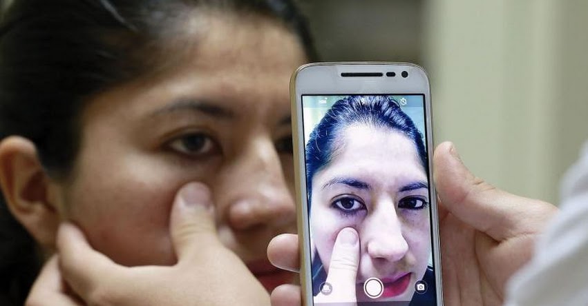 Universidades de Lima norte trabajan método para detectar anemia con fotografía de párpado