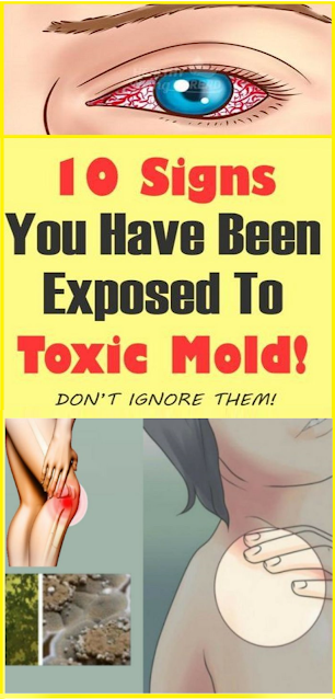 10 Signs You Have Been Exposed To Toxic Mold!