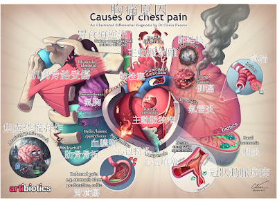 不同器官造成的胸痛，需尋求不同科別醫師的協助