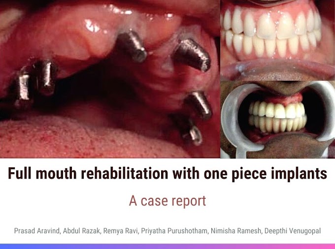 PDF: Full mouth rehabilitation with one piece implants – A case report