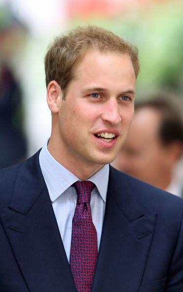 prince william kate middleton_01. prince william hair plugs.