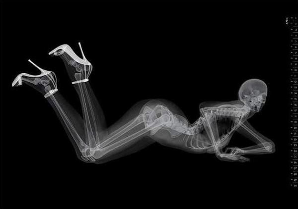 a pose for the Eizo X-ray