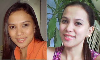 Glutathione skin whitening