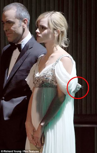 Emma Watson Wardrobe Malfunction