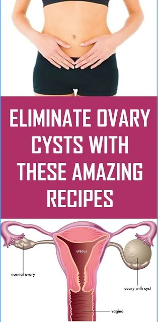 Eliminate Ovary Cysts With These Amazing Recipes