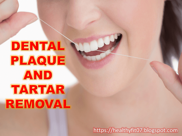 Remove Dental Plaque