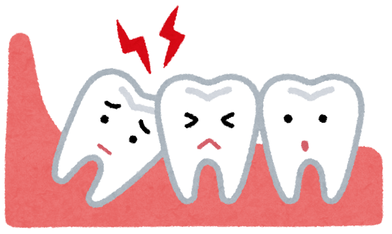 横向きに生えた親知らずのイラスト かわいいフリー素材集 いらすとや