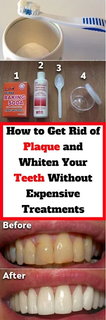 How To Get Rid Of Plaque and Whiten Your Teeth Without Expensive Treatments