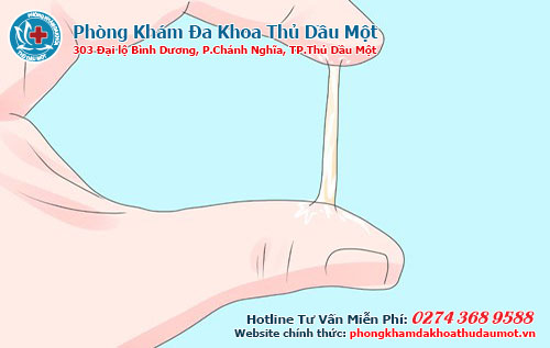 Ở nữ giới bị chảy mủ vùng kín có nguy hiểm không