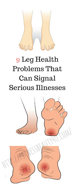 SEE MORE https://brightside.me/inspiration-health/9-leg-health-problems-that-can-signal-serious-illnesses-364160/