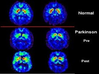 Neurosains Kognitif: Pengertian, Studi-studi, dan Teknik atau Metode