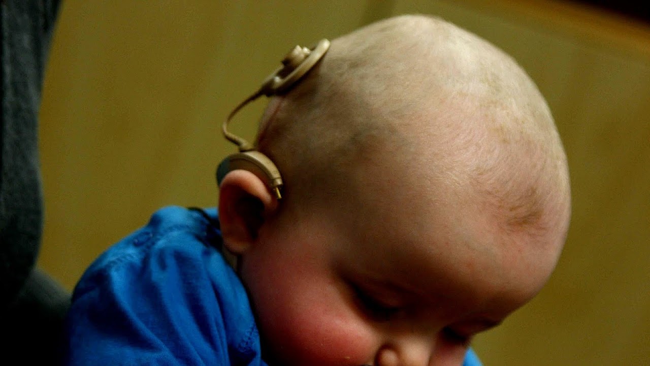 How Effective Are Cochlear Implants In Restoring Hearing