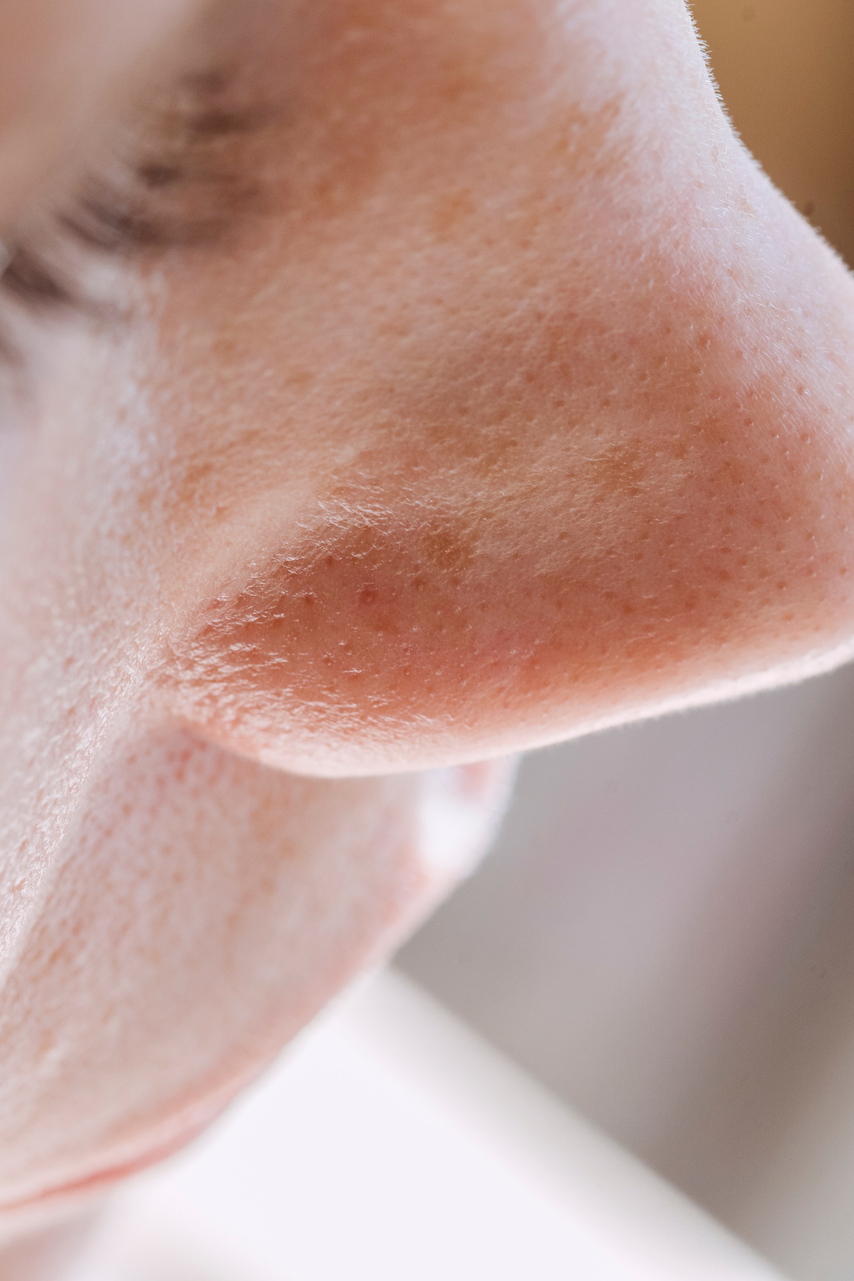 How to get rid of nose pores?