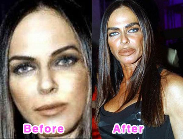 donatella versace before and after plastic surgery. Donatella Versace Before And