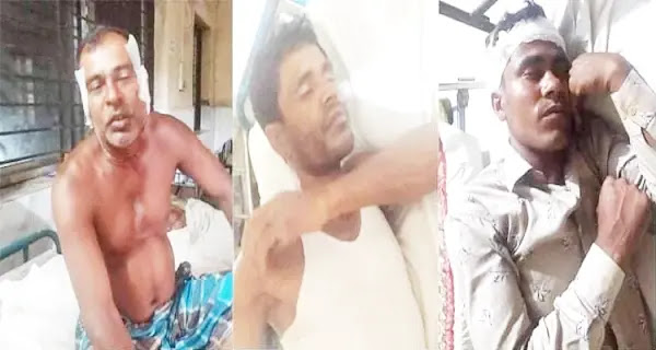 3 minority brothers beaten and injured in Madhavpur, Bangladesh