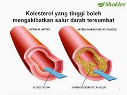 Image result for set jantung shaklee