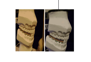 Escultura Dental ELEMENTO 36 YouTube