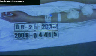 celebrity gossip Michael Jackson's Naked Body Autopsy Photo Shown