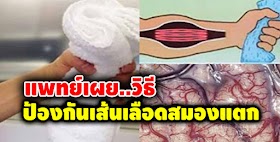 แนะนำให้ลอง เพียงกำผ้าขนหนูแบบนี้ จะช่วยลดความดันได้