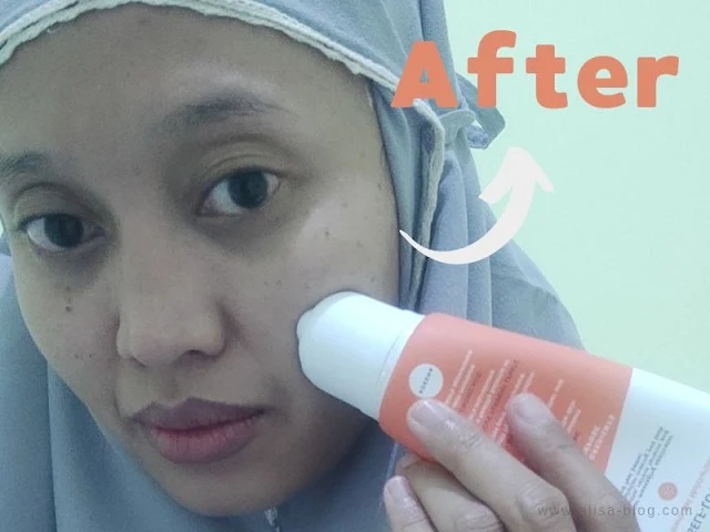 Review Turmeric Gel Moisturizer Adeena