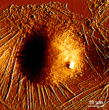 Living fibroblast cell image obtained by AFM