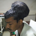 IN INDIA, A SURGEON REMOVES 4-POUND BRAIN TUMOR FROM MAN'S HEAD