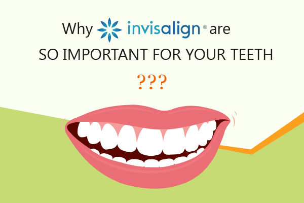 Importance of Invisalign Treatment