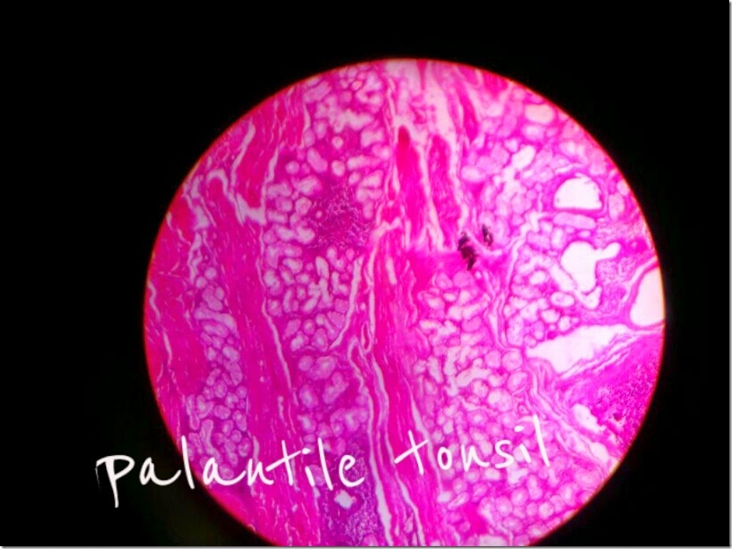 Palatine_tonsil_Histology_slide