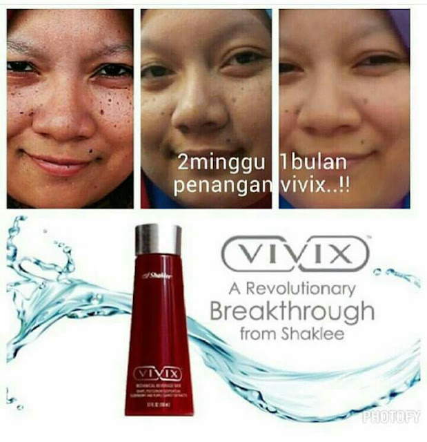 cara hilangkan jeragat cepat dengan vivix shaklee