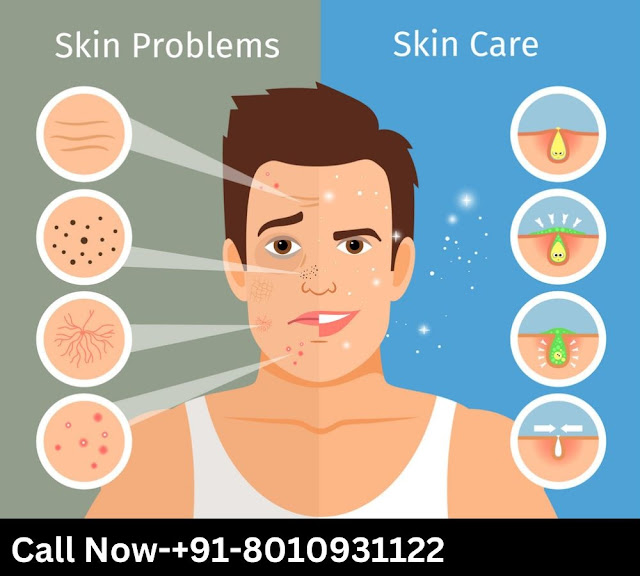 Discover the Top Skin Care Clinic in Rajouri Garden Delhi : Unveiling the Best Options for Radiant Skin