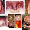 Agen Obat Kencing Nanah Di Maybrat