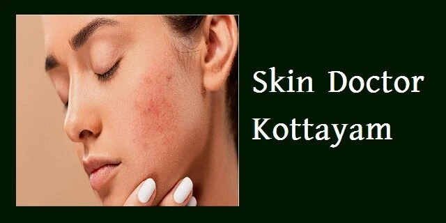 Skin Doctor Kottayam