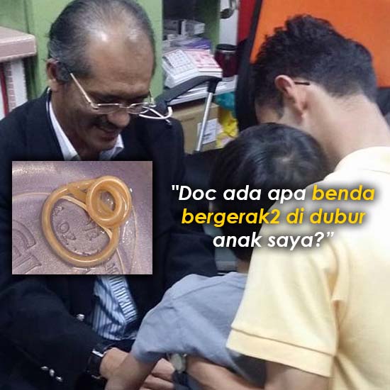 "Apa benda bergerak di dubur anak saya?"