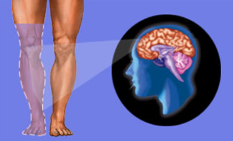 متلازمة ألم الأطراف الوهمي أو الشبحي phantom limb syndrome