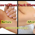 How to Clean Dark Elbows, Naturally Clean Dark Elbows