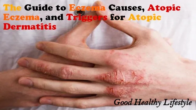 Demystifying Eczema & Atopic Dermatitis: Symptoms and Causes