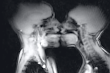 See The Amazing MRI Scan Video That Captured Couple Having Se.x (Graphic Content)