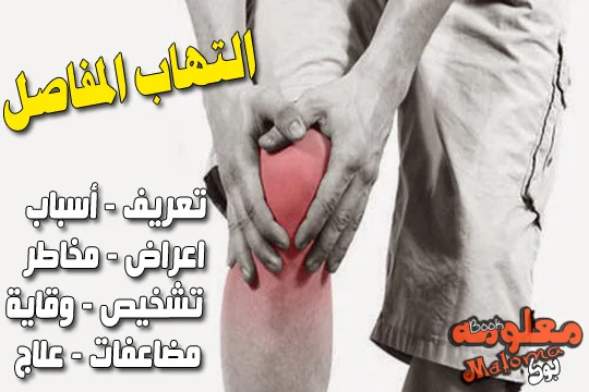 التهاب المفاصل - اسباب - اعراض - تعريف - وقاية - مخاطر - مضاعفات - علاج - تشخيص