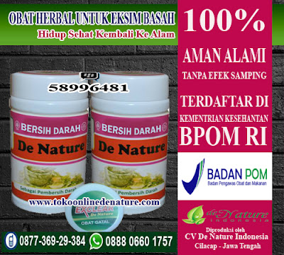 OBAT HERBAL UNTUK EKSIM BASAH