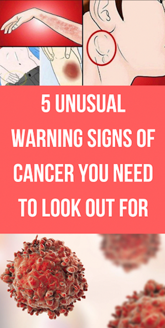5 Unusual Warning Signs Of Cancer You Have To Look Out For