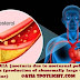 Nocturia, Heart Problems & Brain Infarction