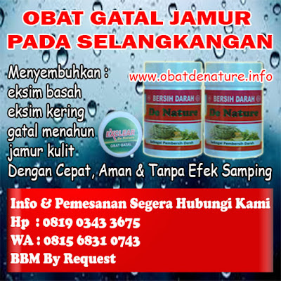 OBAT GATAL JAMUR PADA SELANGKANGAN