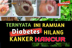 Silahkan Share! KANKER Hancur, Stroke Sembuh Total, Diabetes Musnah, Serangan Jantung Akan Dihambat karena nya Sehingga Peredaran Darah Semakin Lancar.