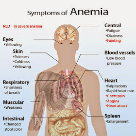 Simptom anemia