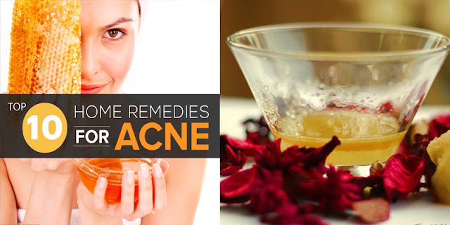 10 Home Remedies For Acne That Really Works