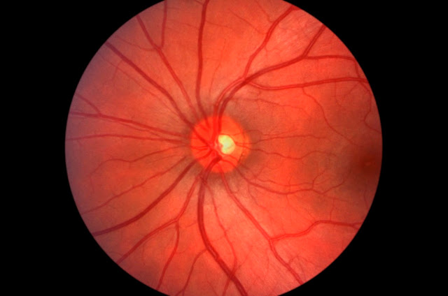 clinica oftalmologia sevilla