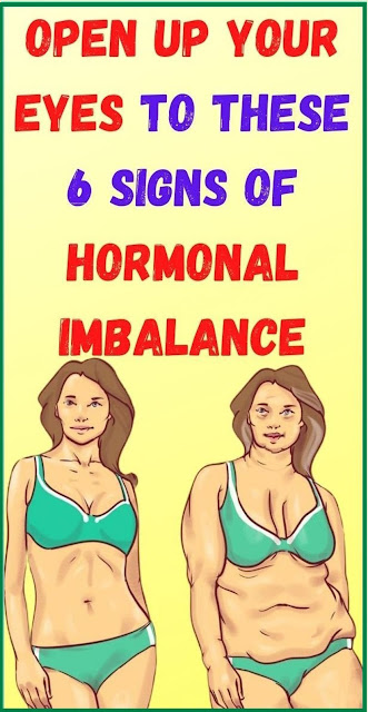 Open Up Your Eyes To These 6 Signs Of Hormonal Imbalance